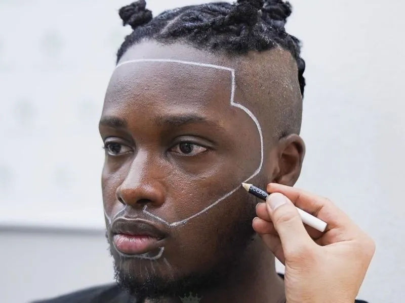 Injerto de barba