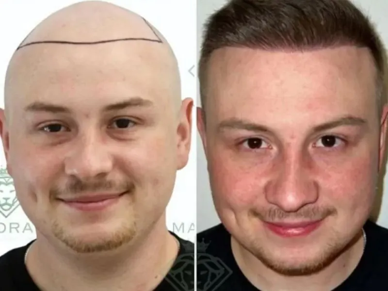 hair clinic