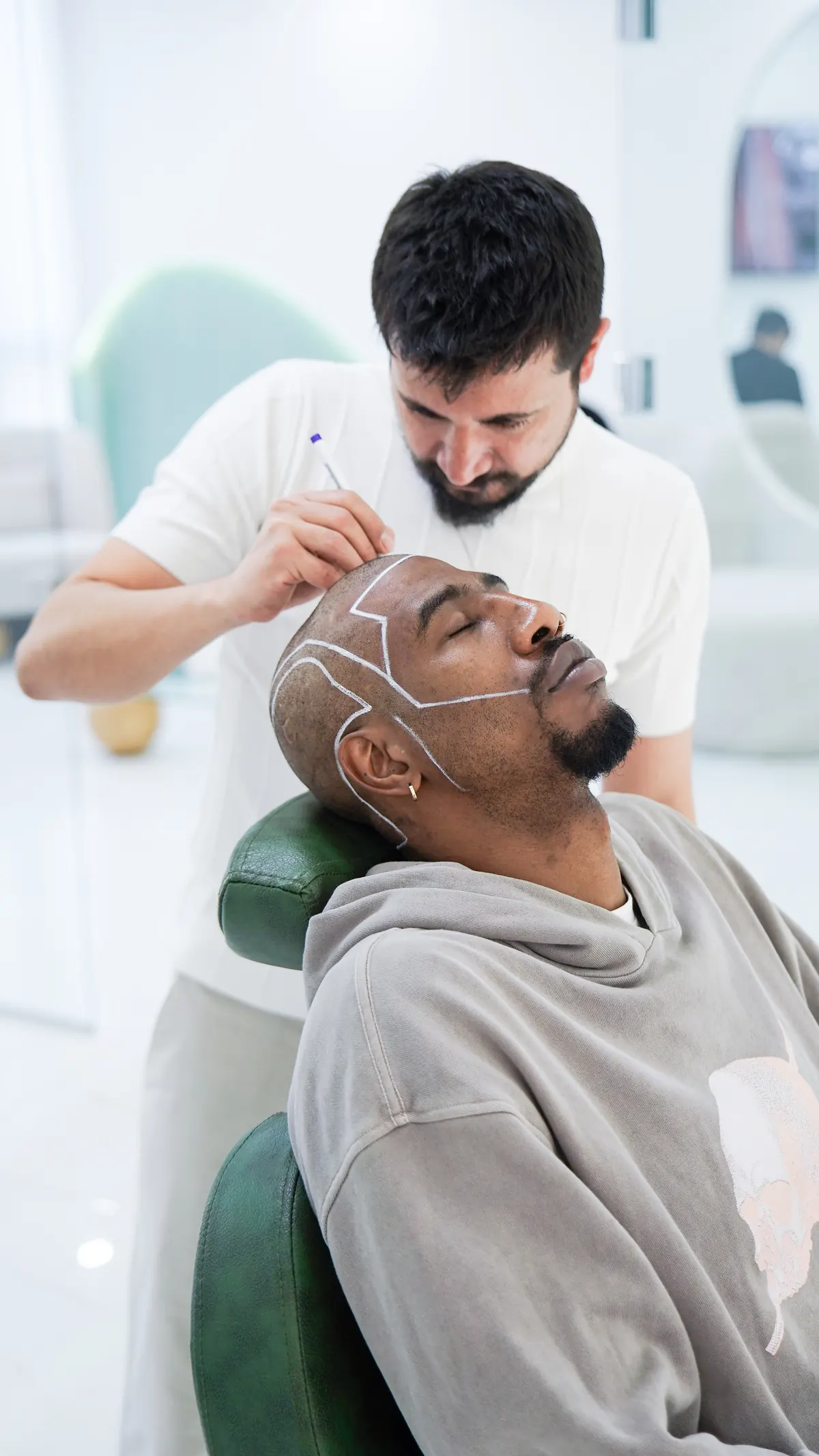 Trapianto di capelli con tecnica DHI