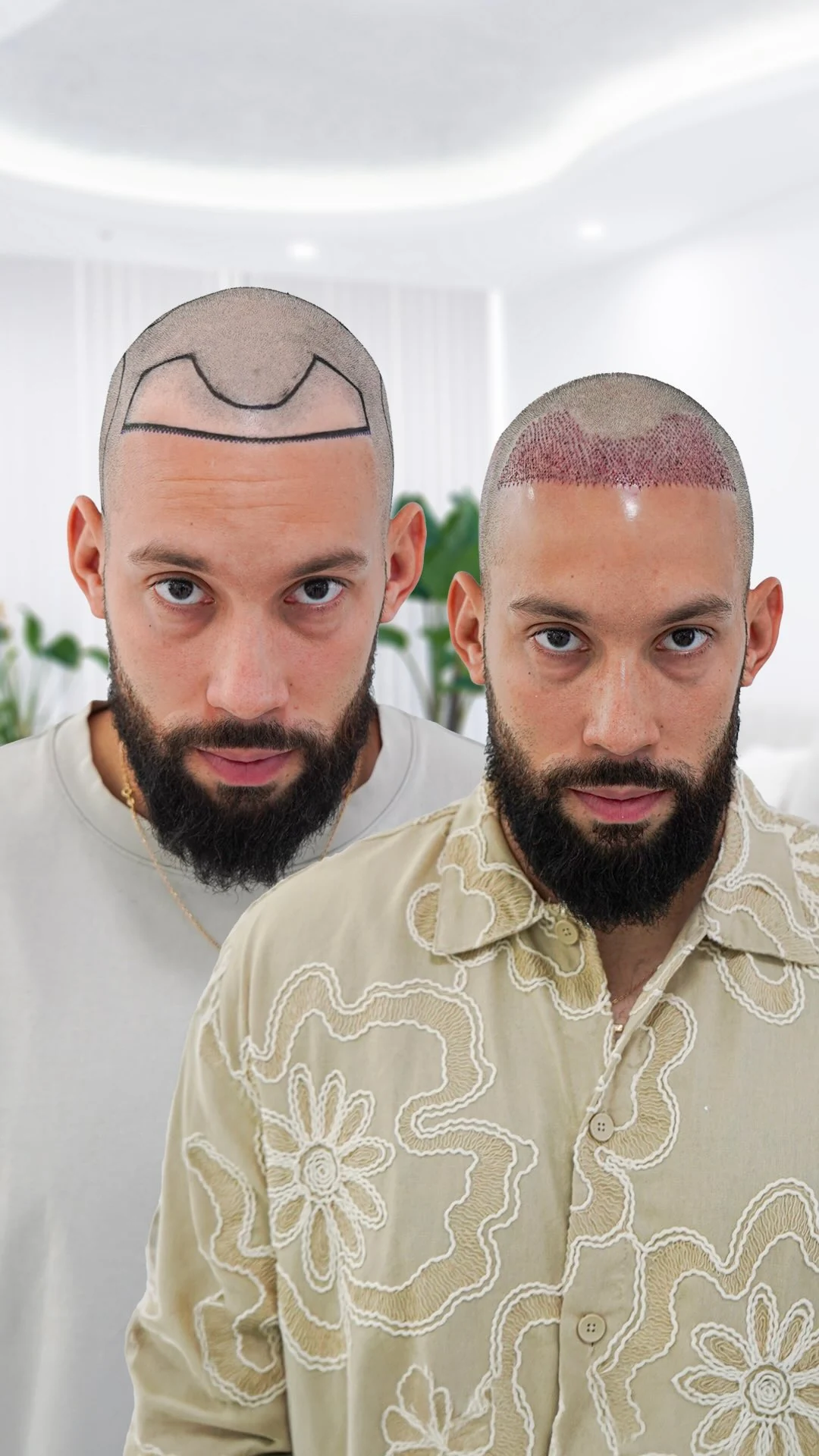 From hairline planning to day one