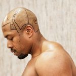 hair transplant surgery