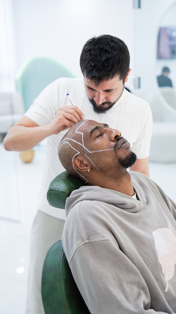 DHI Technique Hair Transplant