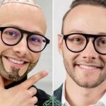 best hair clinic