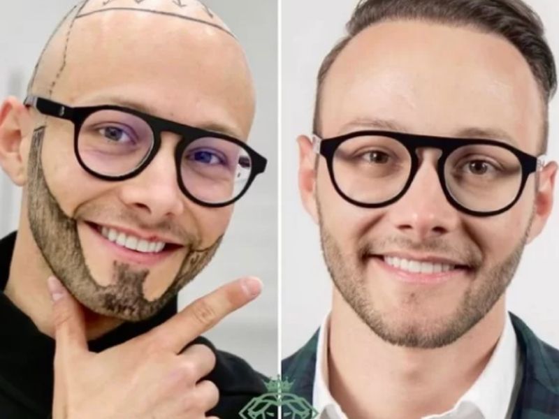 best hair clinic