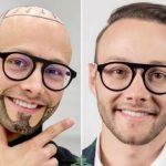 Bald Spot