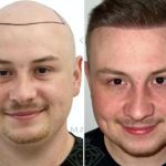 hair clinic