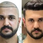 before after