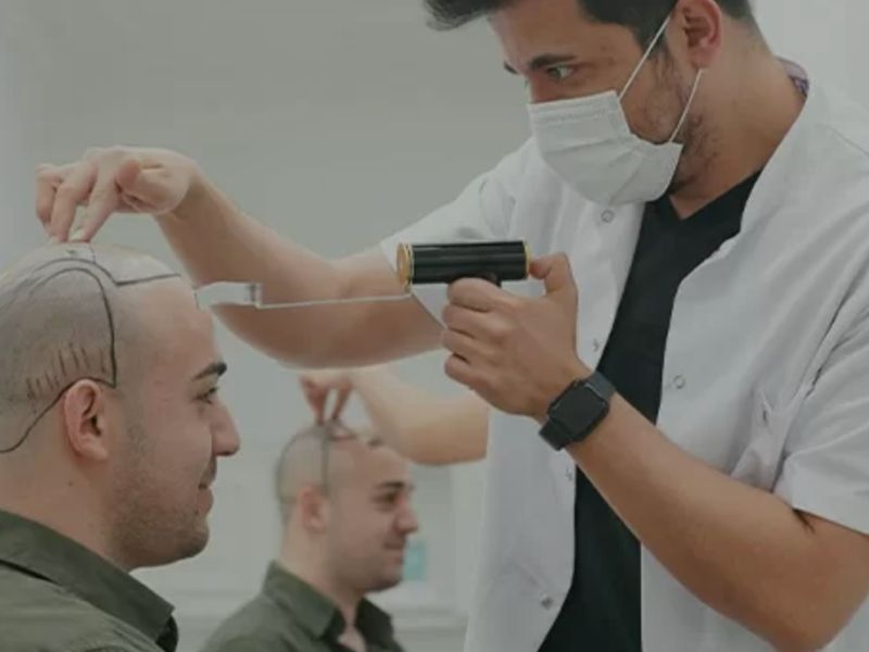 hair transplant